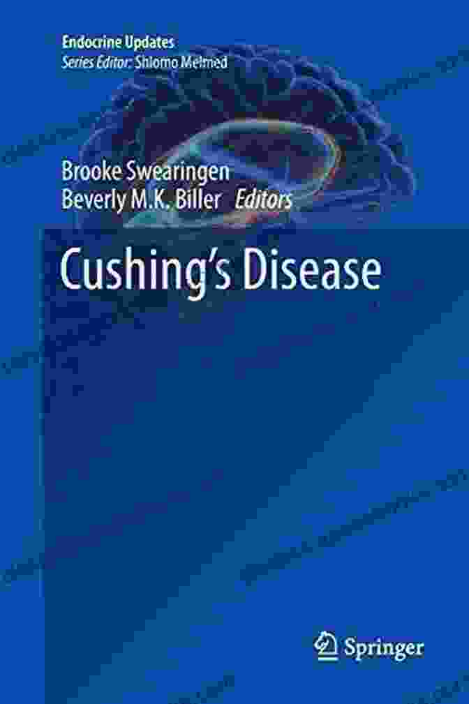 Cushing Disease Endocrine Updates 31 Book Cover Cushing S Disease (Endocrine Updates 31)