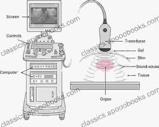 Ultrasound Machine With Labeled Controls Ultrasonography In The ICU: Practical Applications